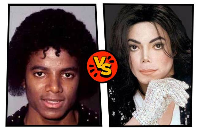 Fekete Michael Jackson vagy fehér Michael Jackson?