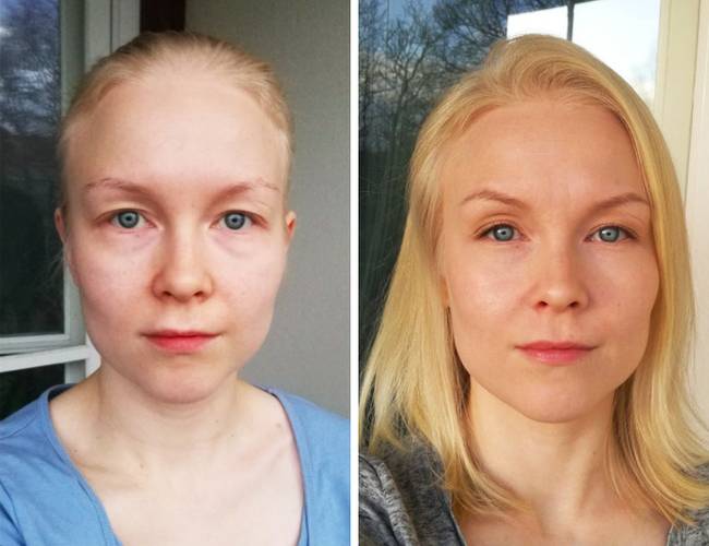 „Így néz ki az én mindennapos „no makeup” sminkem, táskás szemekre.”