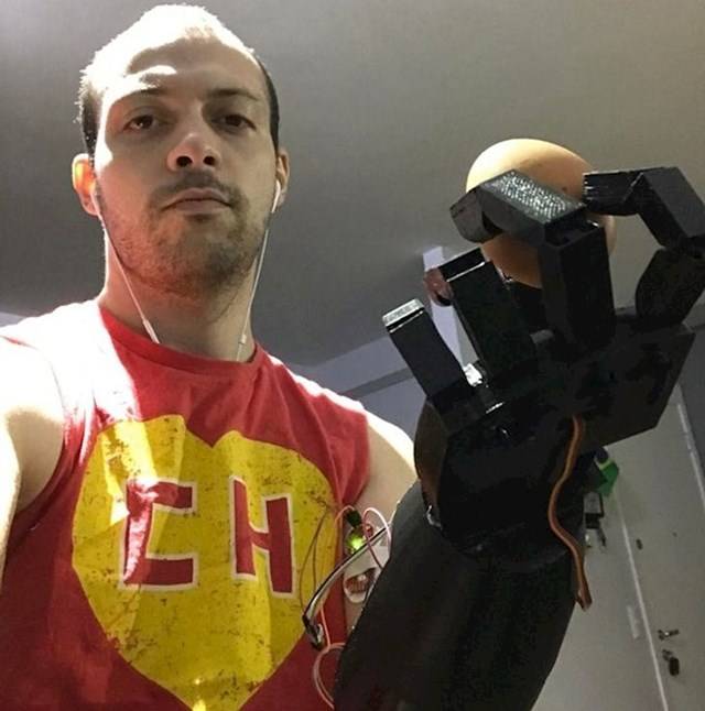 „Kar nélkül születtem, ezért a 3D technológia segítségével saját protézist készítettem."