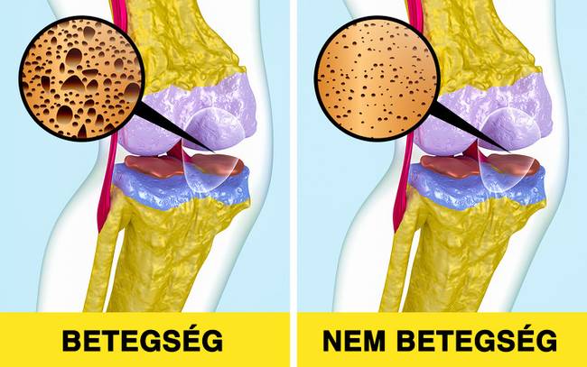 A gyógyszeripari vállalatok "feltalálnak" betegségeket.