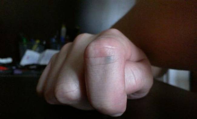 „Ez a grafitceruza hegy 13 évvel ezelőtt szúródott az ujjamba.''