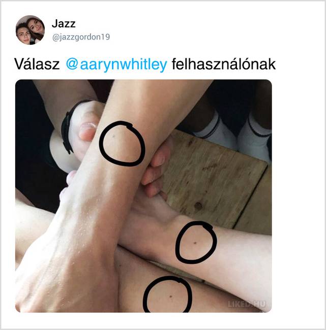 Egy véletlen Tweetből kiderült, hogy a világon majdnem minden nőnek pontosan ugyanolyan anyajegye van
