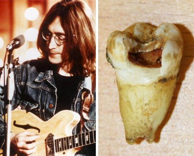 John Lennon foga - $31,200 (~7,9 millió forint)
