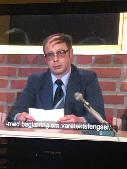 Kopasz fej? Milyen kopasz fej?! Hisz' ott a haj.
