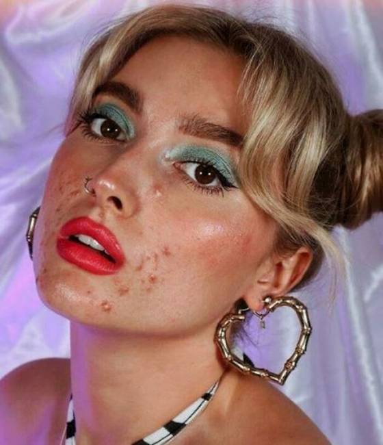 Egy sminkmárka, ami pattanásos modelleket is alkalmaz, nemcsak tökéletes bőrű lányokat.