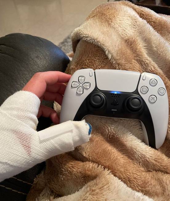 „Ma kaptam egy PlayStation 5-öt. Azon a napon, amikor eltörtem a hüvelykujjam."