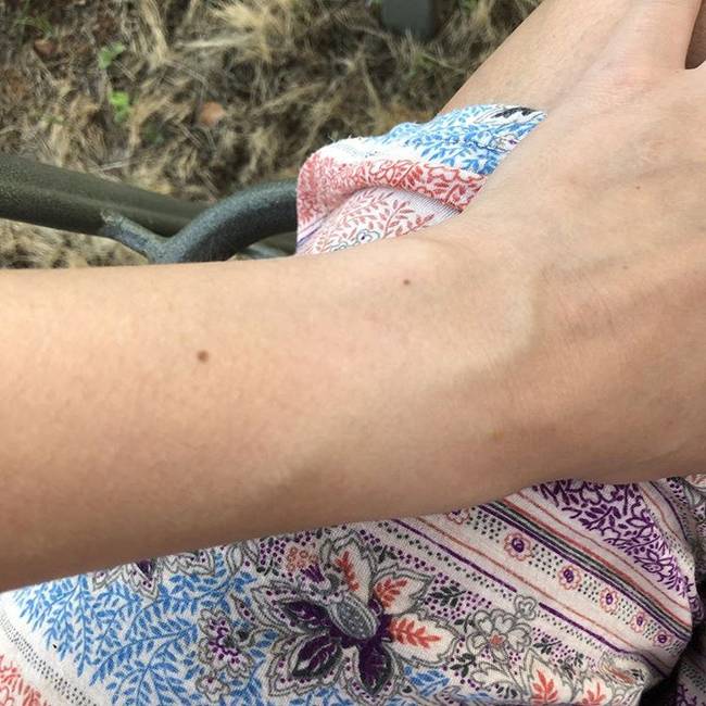 Egy véletlen Tweetből kiderült, hogy a világon majdnem minden nőnek pontosan ugyanolyan anyajegye van