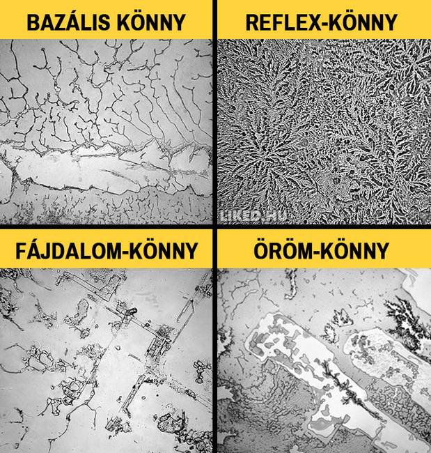 Többféle könnyünk van.