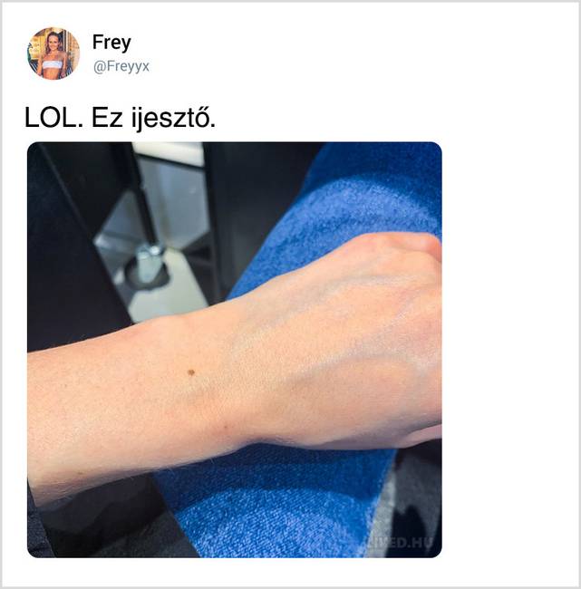 Egy véletlen Tweetből kiderült, hogy a világon majdnem minden nőnek pontosan ugyanolyan anyajegye van