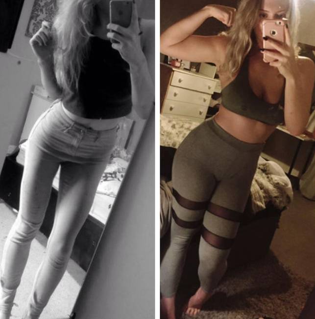 „Anorexiás voltam és depressziós. Azóta 15 kilogrammot sikerült felszednem - soha nem voltam még ilyen jól táplált és boldog."