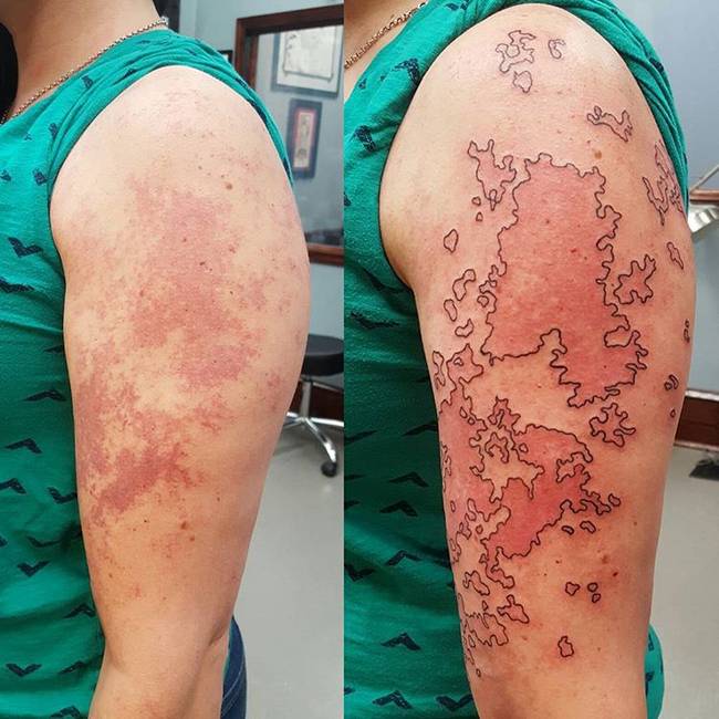 20 fantasztikus tetoválás, ami műalkotássá varázsolta az anyajegyeket és hegeket