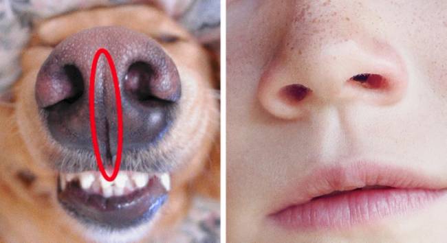 philtrum