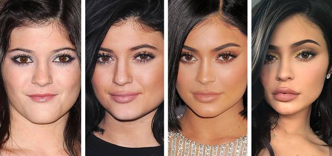 Kylie Jenner száj