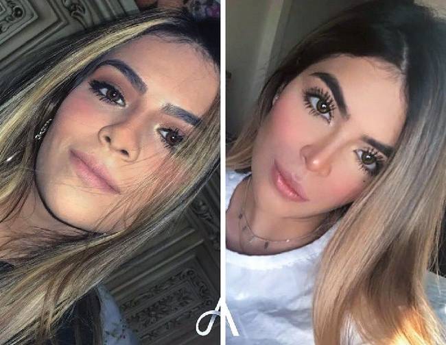 20 nő, aki megcsináltatta az orrát, és most nem hiszed el, hogy ugyanaz a személy van a fotón