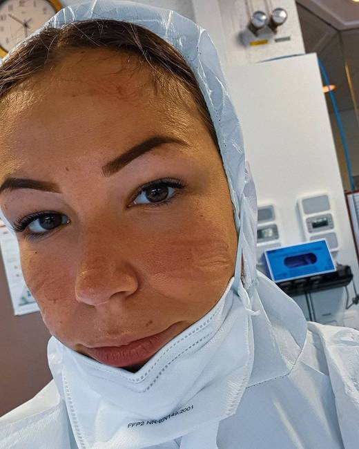 „Igen, mindent verejték borít. És igen, mindennap ilyen lenyomatokat látok az arcomon, amikor tükörbe nézek."