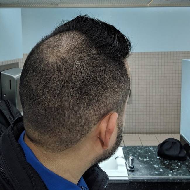 „Divatos frizurát szerettem volna, de nem erre számítottam."