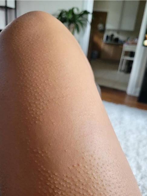 „Van egy rész a lábamon, ami sohasem libabőrös.''