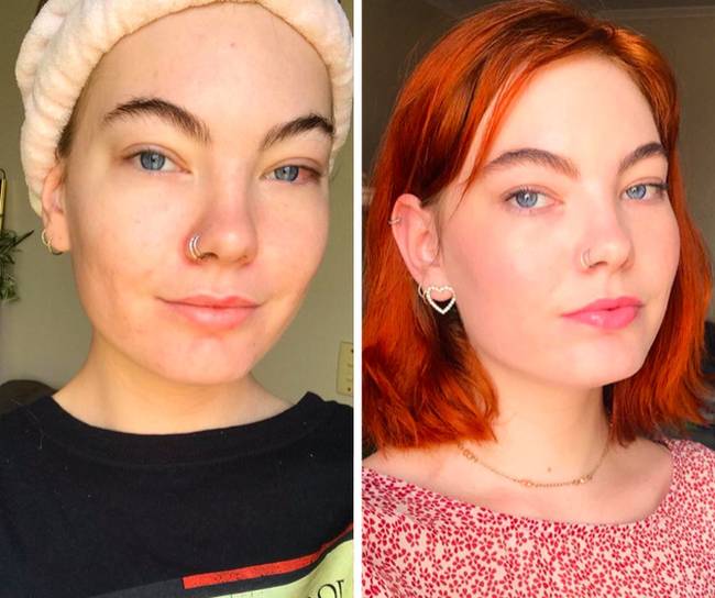 „Sminkelés előtt és a no makeup smink után. Sok évnyi pattanás elleni harc után végre elégedett vagyok a bőrömmel.”
