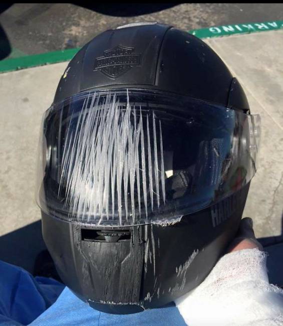 Neeem, nem 100 vagy 200 km/h-s sebességgel történt a baleset, pusztán 40 km/h-s sebességgel bukott egyet, és végigpuszilta az aszfaltot…az arcán nyilván még súlyosabb nyomokat hagyott volna.