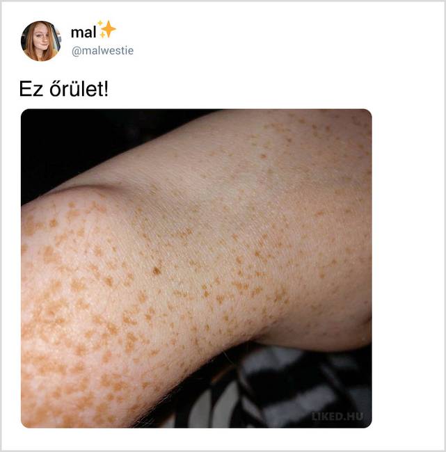 Egy véletlen Tweetből kiderült, hogy a világon majdnem minden nőnek pontosan ugyanolyan anyajegye van