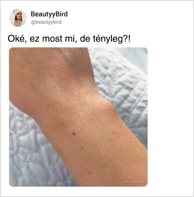 Egy véletlen Tweetből kiderült, hogy a világon majdnem minden nőnek pontosan ugyanolyan anyajegye van