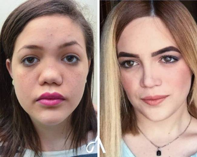 20 nő, aki megcsináltatta az orrát, és most nem hiszed el, hogy ugyanaz a személy van a fotón