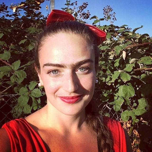 Gyerekkorában Eldinát sok kritika érte a testét borító, szokatlanul erős szőrzet miatt.