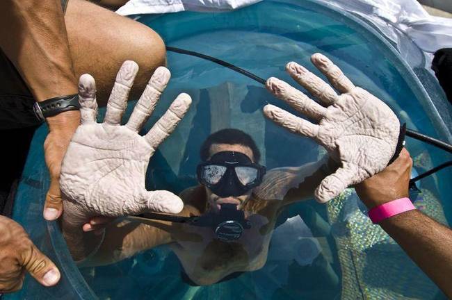Az illuzionista David Blaine keze, miután 7 napot töltött a víz alatt.