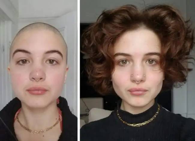 Előtte utána fotók 023