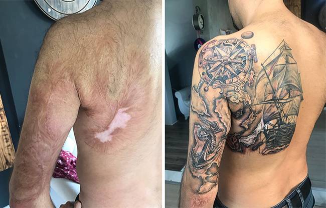20 alkalom, amikor a tetoválóművészek tökéletesen eltüntették az anyajegyeket és sérüléseket
