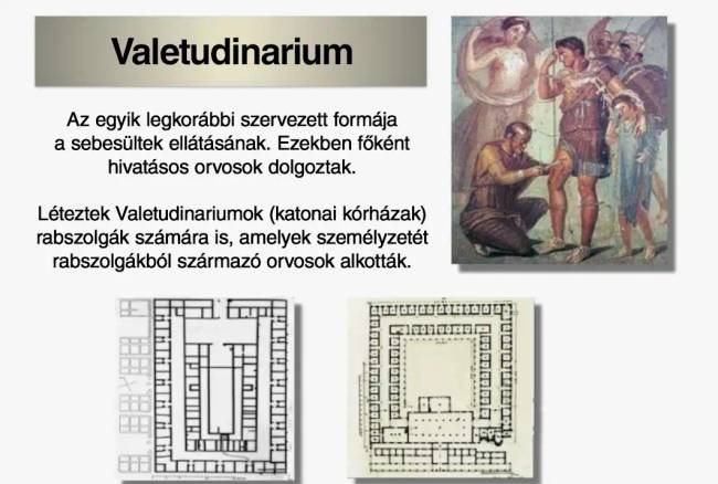 Mit csináltak régen a sebesültekkel a csaták után? Elmesélem részletesen