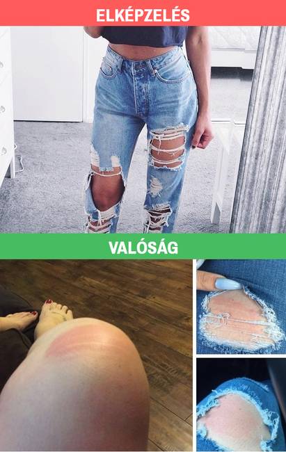 A divatos szaggatott nadrágnak is megvannak a maga hátulütői...