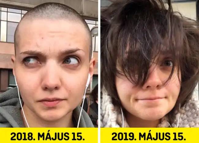 Fényképes összehasonlítások 010