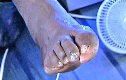 Ahogy Shaquille O’Neal lába is.