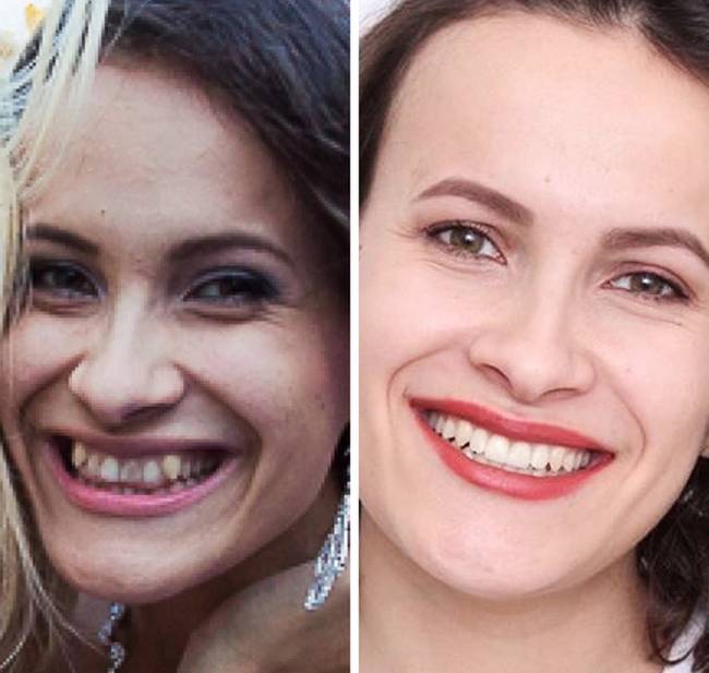 „A mosoly, ami egy orvos aranykezének, 2 év türelemnek, jó sok pénznek, és néhány fájdalomtól álmatlan éjszakának köszönhető.”