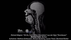 MRI felvétel egy operaénekesről, éneklés közben.