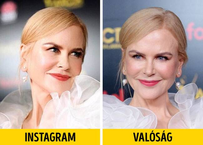 Nicole Kidman