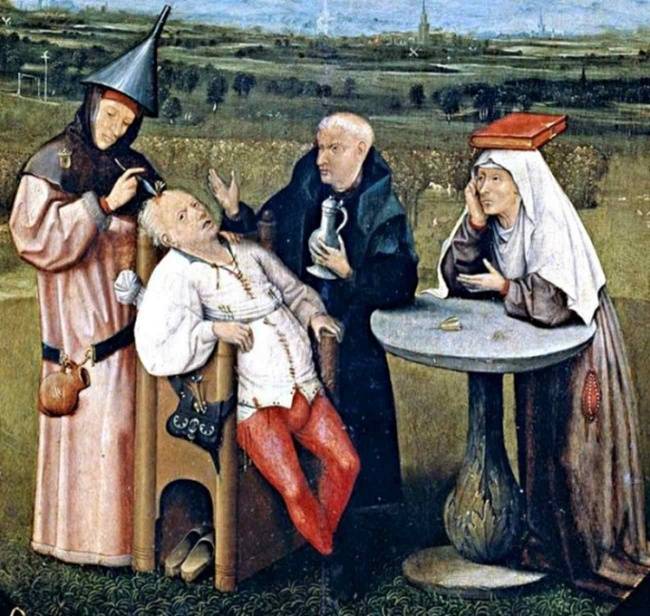 Az emberek kilyukasztották a koponyájukat, hogy elűzzék a gonosz szellemeket.