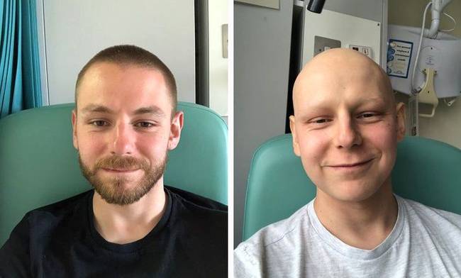 „A képek 3 hónap különbséggel készültek a nehéz kemoterápiás kezelés előtt és után."