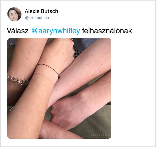 Egy véletlen Tweetből kiderült, hogy a világon majdnem minden nőnek pontosan ugyanolyan anyajegye van