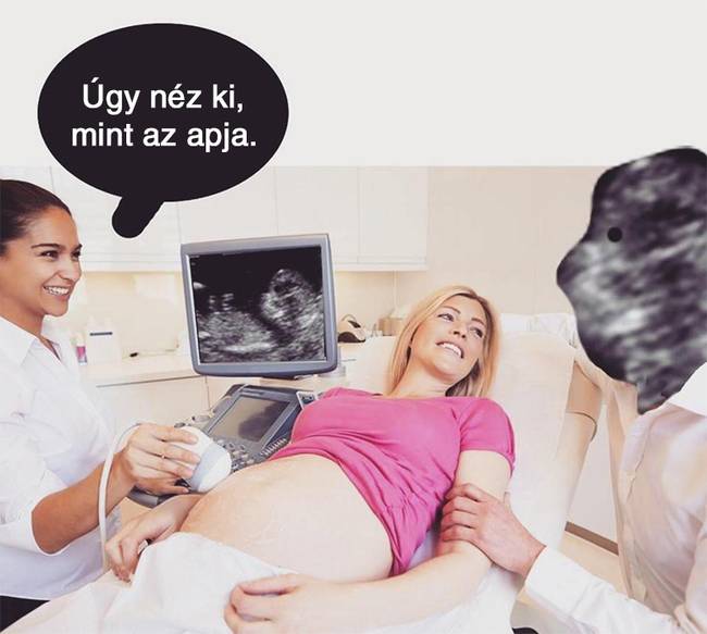 20 vicces terhességgel kapcsolatos mém, ami többet mond minden szónál