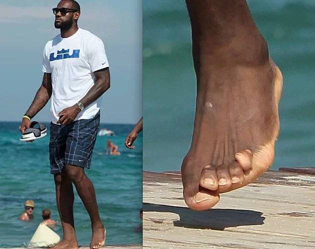 A kosárlabdázó LeBron James lába is megsínylette a sportolással töltött éveket.