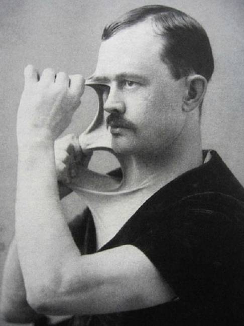 Egy hihetetlenül rugalmas bőrű ember az 1900-as évek elejéről.