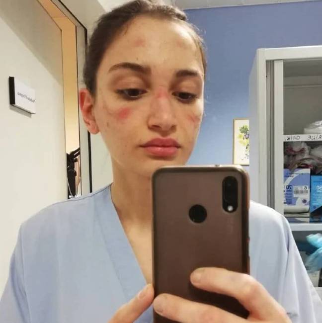 A nővérként dolgozó Alessia Bonari nemcsak az arcáról készült fotót osztotta meg, hanem a gondolatait is a munkájáról.