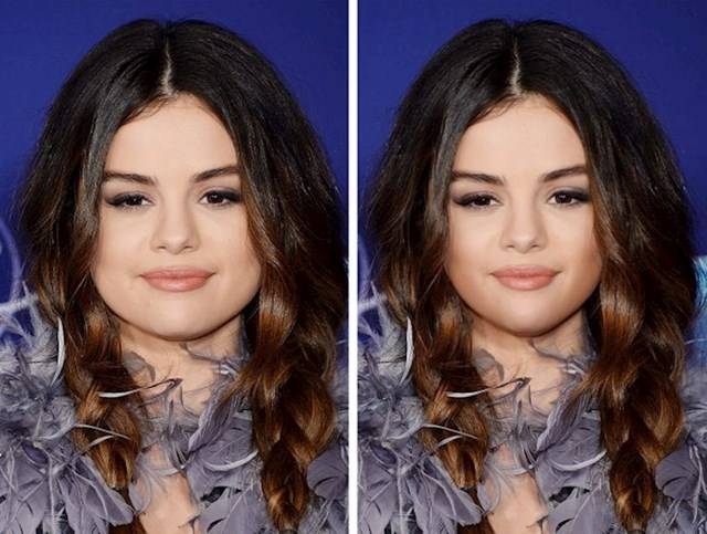 Selena Gomez pufók arca
