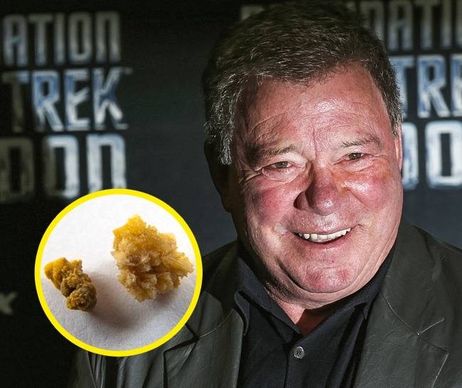 William Shatner veseköve - $25,000 (~6,3 millió forint)