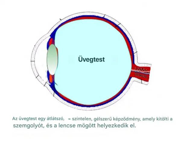 Az üvegtest elhelyezkedése a szemben.