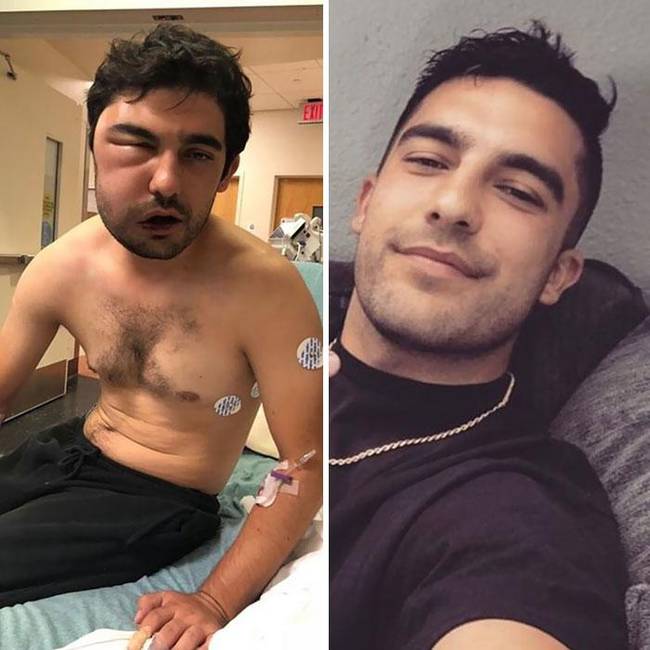 „8 hónappal azután, hogy egy majdnem halálos túladagolás után úgy döntöttem, hogy örökre leteszem a kábítószert."