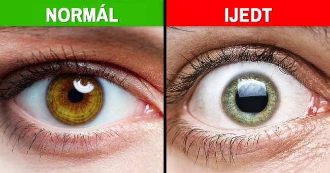 Amikor félünk, a pupillánk kitágul, hogy jobban láthassuk a közvetlen környezetünket.