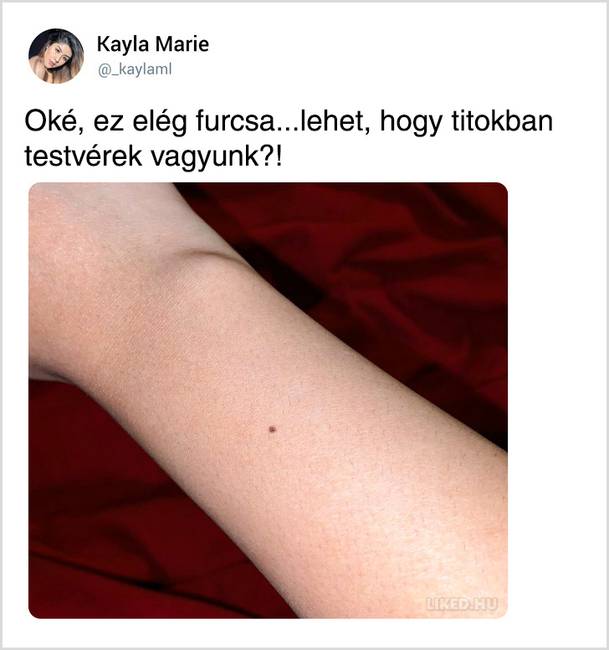 Hirtelen egy csomó lány fedezett fel hasonló jellegzetességet a testén, és egy komplett flash mob indult el a közösségi oldalon.